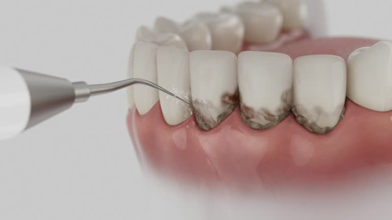 Reliable Wisdom Tooth Removal contractor in Wyoming County County, WV by Dentist Open Now